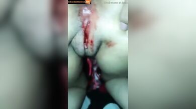 Young girl shows period blood in sexy mms